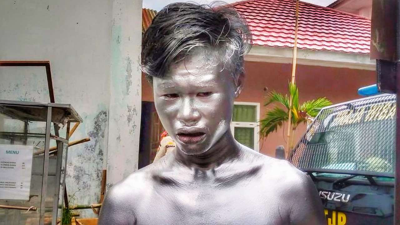 LBH Apresiasi Komnas HAM Usut Dugaan Penyiksaan Manusia Silver